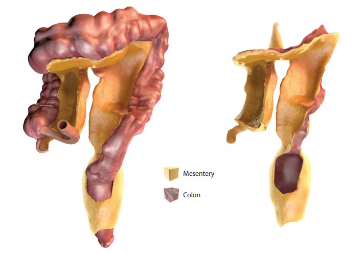 Schéma d'une partie de l'appareil intestinal : la zone jaune orangée est le mésentère.