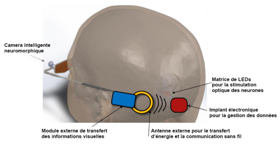 Le projet CorticalSight mêle dispositifs interne et externe.