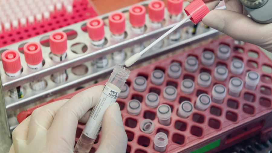 Plutôt que les tests PCR, très développés en Allemagne comme ici à Dresde, le Gouvernement français mise ses espoirs sur les tests de sérologie, encore en développement, pour accompagner le déconfinement.