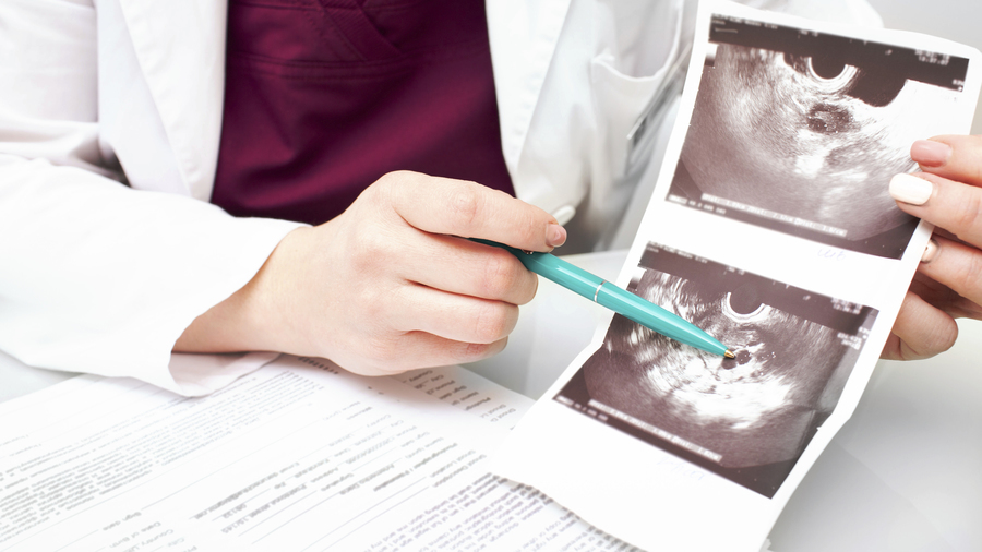 Pour les 10% de Françaises touchées par l'endométriose, l'accès précoce à des soins pluridisciplinaires de qualité est essentiel au regard de la complexité diagnostique et de prise en charge liée aux différentes dimensions de la maladie. (SPL/BSIP)