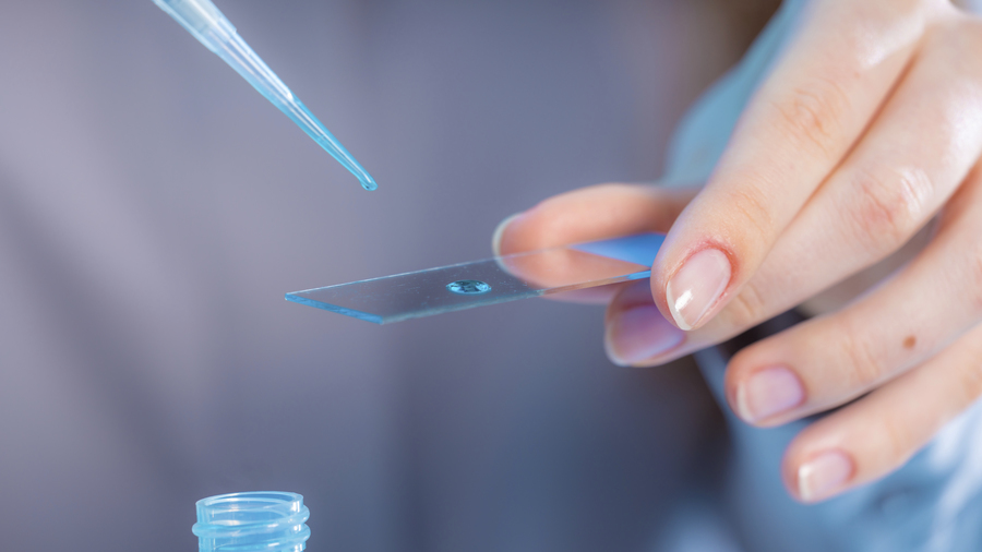 Les moyens des appels à projets de recherche sur les soins et l'offre de soins restent majoritairement alloués aux projets promus par les CHU. (SPL/BSIP)