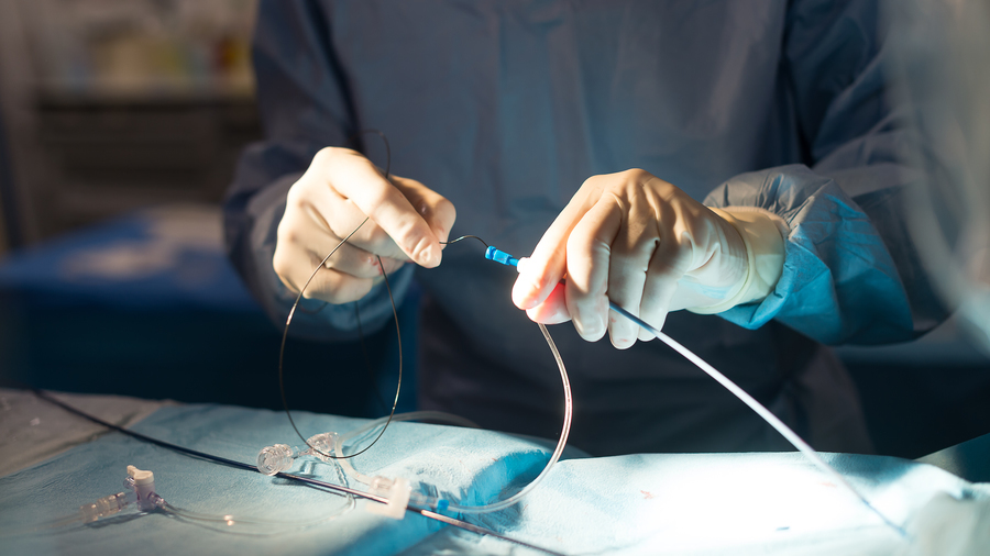 Le retrait de la liste en sus des cathéters de thrombo-aspiration fait craindre un moindre recours à la thrombectomie mécanique, malgré ses bénéfices médico-économiques. (A. Noor/Image Point FR/BSIP)