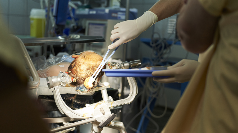 La chirurgie pédiatrique est reconnue comme une modalité dans les autorisations, mais l'absence de spécialité dans l'anesthésie-réanimation complique l'accès effectif des enfants aux blocs opératoires. (Bienaimé/ BSIP)