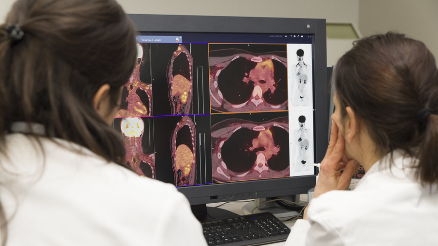 Après quatre années de mise en œuvre du plan européen pour vaincre le cancer, la commission sénatoriale des affaires européennes dresse un premier bilan de ce plan et présente des propositions pour élargir les ambitions européennes. (A.Noor/image Point FR/BSIP)