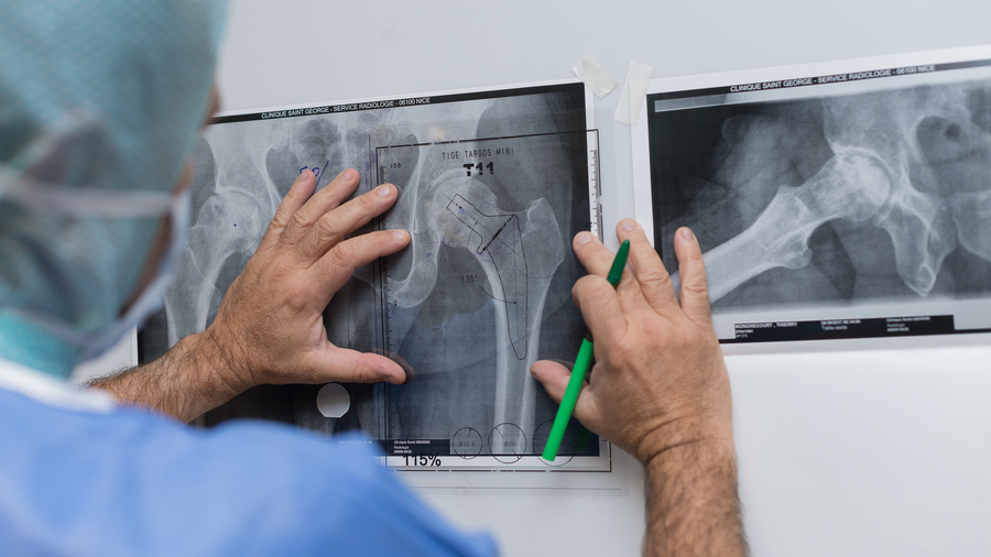 Les différents contacts avec des spécialistes exposent davantage les patients bénéficiaires de la pose d'une prothèse de la hanche à des dépassements d'honoraires. En moyenne, la facture cumulée lors de cet épisode de soins est de 700 euros, mais peut dépasser le double dans certains cas. (A. Noor/Image Point FR/BSIP)